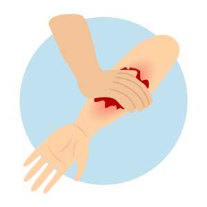 Bleeding image